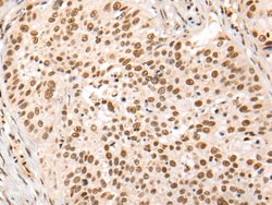 Invitrogen HOXA7 Polyclonal Antibody 100 &mu;L | Buy Online | Invitrogen&trade; | Fisher Scientific