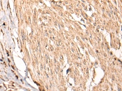Invitrogen HSF4 Polyclonal Antibody 100 &mu;L; Unconjugated:Antibodies,