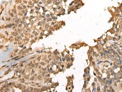 Invitrogen MEIOB Polyclonal Antibody 100 &mu;L; Unconjugated:Antibodies,