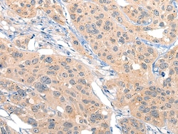 Invitrogen MIIP Polyclonal Antibody 100 &mu;L; Unconjugated:Antibodies,