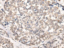 Invitrogen NREP Polyclonal Antibody 100 &mu;L; Unconjugated:Antibodies,