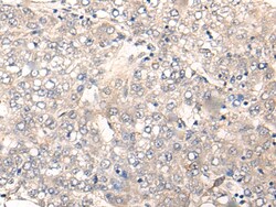 Invitrogen NREP Polyclonal Antibody 100 &mu;L; Unconjugated:Antibodies,