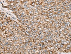 Invitrogen PCDHGB5 Polyclonal Antibody 100 &mu;L; Unconjugated:Antibodies,