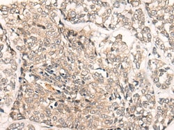 Invitrogen SLC5A8 Polyclonal Antibody 100 &mu;L; Unconjugated:Antibodies,