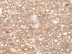 Invitrogen SLC5A8 Polyclonal Antibody 100 &mu;L; Unconjugated:Antibodies,