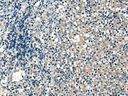 USP12 Polyclonal Antibody:Antibodies, Polyclonal