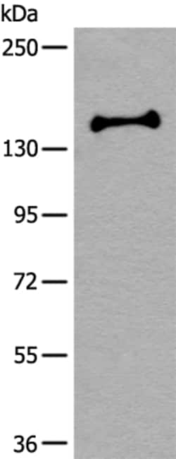 Invitrogen UTY Polyclonal Antibody 100 &mu;L; Unconjugated:Antibodies,
