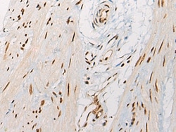 Invitrogen VGLL3 Polyclonal Antibody 100 &mu;L; Unconjugated:Antibodies,