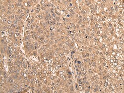 Invitrogen WDFY3 Polyclonal Antibody 100 &mu;L; Unconjugated:Antibodies,