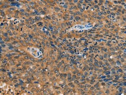 Invitrogen YTHDF1 Polyclonal Antibody 100 &mu;L; Unconjugated:Antibodies,