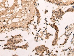 Invitrogen ZNF467 Polyclonal Antibody 100 &mu;L; Unconjugated:Antibodies,