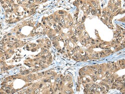 Invitrogen ZNF468 Polyclonal Antibody 100 &mu;L; Unconjugated:Antibodies,