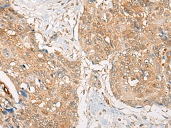 Invitrogen ZXDA Polyclonal Antibody 100 &mu;L; Unconjugated:Antibodies,
