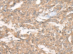 Invitrogen ZXDA Polyclonal Antibody 100 &mu;L; Unconjugated:Antibodies,