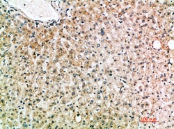 Invitrogen IL-19 Polyclonal Antibody 100 &mu;L; Unconjugated:Antibodies,