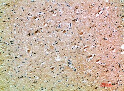 Invitrogen Oncostatin M Polyclonal Antibody 100 &mu;L; Unconjugated:Antistoffer