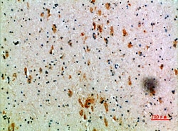 Invitrogen KIR3DL2 Polyclonal Antibody 100 &mu;L; Unconjugated:Antibodies,