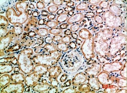 Invitrogen KIR3DL2 Polyclonal Antibody 100 &mu;L; Unconjugated:Antibodies,