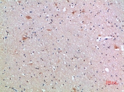 Invitrogen FZD9 Polyclonal Antibody 100 &mu;L; Unconjugated:Antibodies,
