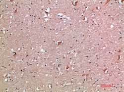 Invitrogen IL18RAP Polyclonal Antibody 100 &mu;L; Unconjugated:Antibodies,