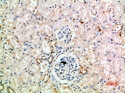 Invitrogen IL18RAP Polyclonal Antibody 100 &mu;L; Unconjugated:Antibodies,