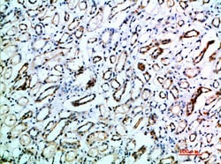 Invitrogen TSPAN7 Polyclonal Antibody 100 &mu;L; Unconjugated:Antibodies,