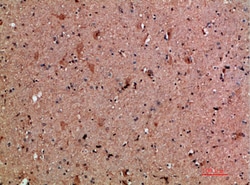 Invitrogen NNT1 Polyclonal Antibody 100 &mu;L; Unconjugated:Antibodies,