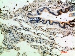 Invitrogen Thrombospondin 4 Polyclonal Antibody 100 &mu;L; Unconjugated:Antibodies,