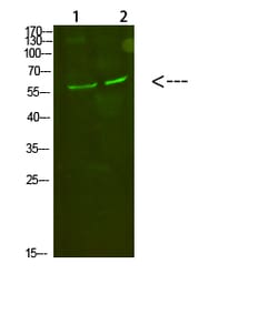 Invitrogen C8A Polyclonal Antibody 100 &mu;L; Unconjugated:Antibodies,