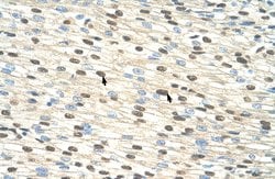 Invitrogen RIP3 Polyclonal Antibody 100 &mu;L; Unconjugated:Antibodies,
