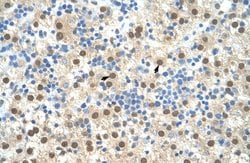 Invitrogen RIP3 Polyclonal Antibody 100 &mu;L; Unconjugated:Antibodies,