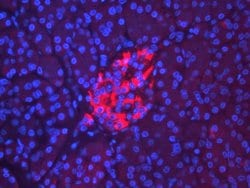Invitrogen RIP3 Polyclonal Antibody 100 &mu;L; Unconjugated:Antibodies,