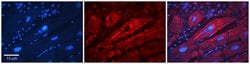 Invitrogen SLC26A3 Polyclonal Antibody 100 &mu;L; Unconjugated:Antibodies,