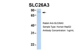 Invitrogen SLC26A3 Polyclonal Antibody 100 &mu;L; Unconjugated:Antibodies,