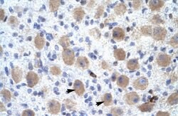 Invitrogen OR13C2/OR13C9 Polyclonal Antibody 100 &mu;L; Unconjugated:Antibodies,