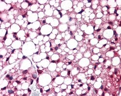 Invitrogen ATF6 Polyclonal Antibody 100 &mu;L; Unconjugated:Antibodies,