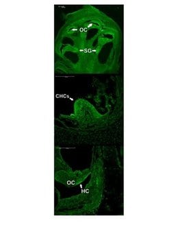 Invitrogen ATOH1 Polyclonal Antibody 100 &mu;L; Unconjugated:Antibodies,