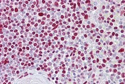 Invitrogen ATOH1 Polyclonal Antibody 100 &mu;L; Unconjugated:Antibodies,
