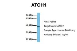 Invitrogen ATOH1 Polyclonal Antibody 100 &mu;L; Unconjugated:Antibodies,