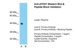 Invitrogen ATOH1 Polyclonal Antibody 100 &mu;L; Unconjugated:Antibodies,