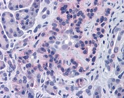 Invitrogen SIRT4 Polyclonal Antibody 100 &mu;L; Unconjugated:Antibodies,
