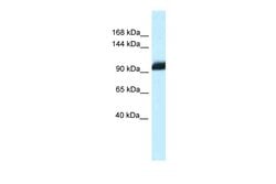 Invitrogen ZHX1 Polyclonal Antibody 100 &mu;L; Unconjugated:Antibodies,