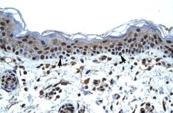 Invitrogen IKZF5 Polyclonal Antibody 100 &mu;L; Unconjugated:Antibodies,