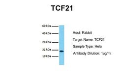 Invitrogen TCF21 Polyclonal Antibody 100 &mu;L; Unconjugated:Antibodies,