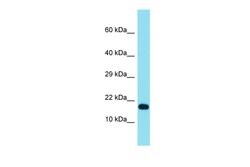Invitrogen TCF21 Polyclonal Antibody 100 &mu;L; Unconjugated:Antibodies,