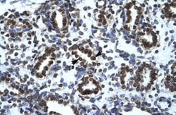 Invitrogen HIC5 Polyclonal Antibody 100 &mu;L; Unconjugated:Antibodies,