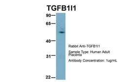 Invitrogen HIC5 Polyclonal Antibody 100 &mu;L; Unconjugated:Antibodies,
