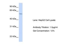 Invitrogen ACAT2 Polyclonal Antibody 100 &mu;L; Unconjugated:Antibodies,