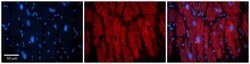 Invitrogen KIF23 Polyclonal Antibody 100 &mu;L; Unconjugated:Antibodies,