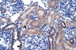 Invitrogen RGS13 Polyclonal Antibody 100 &mu;L; Unconjugated:Antibodies,